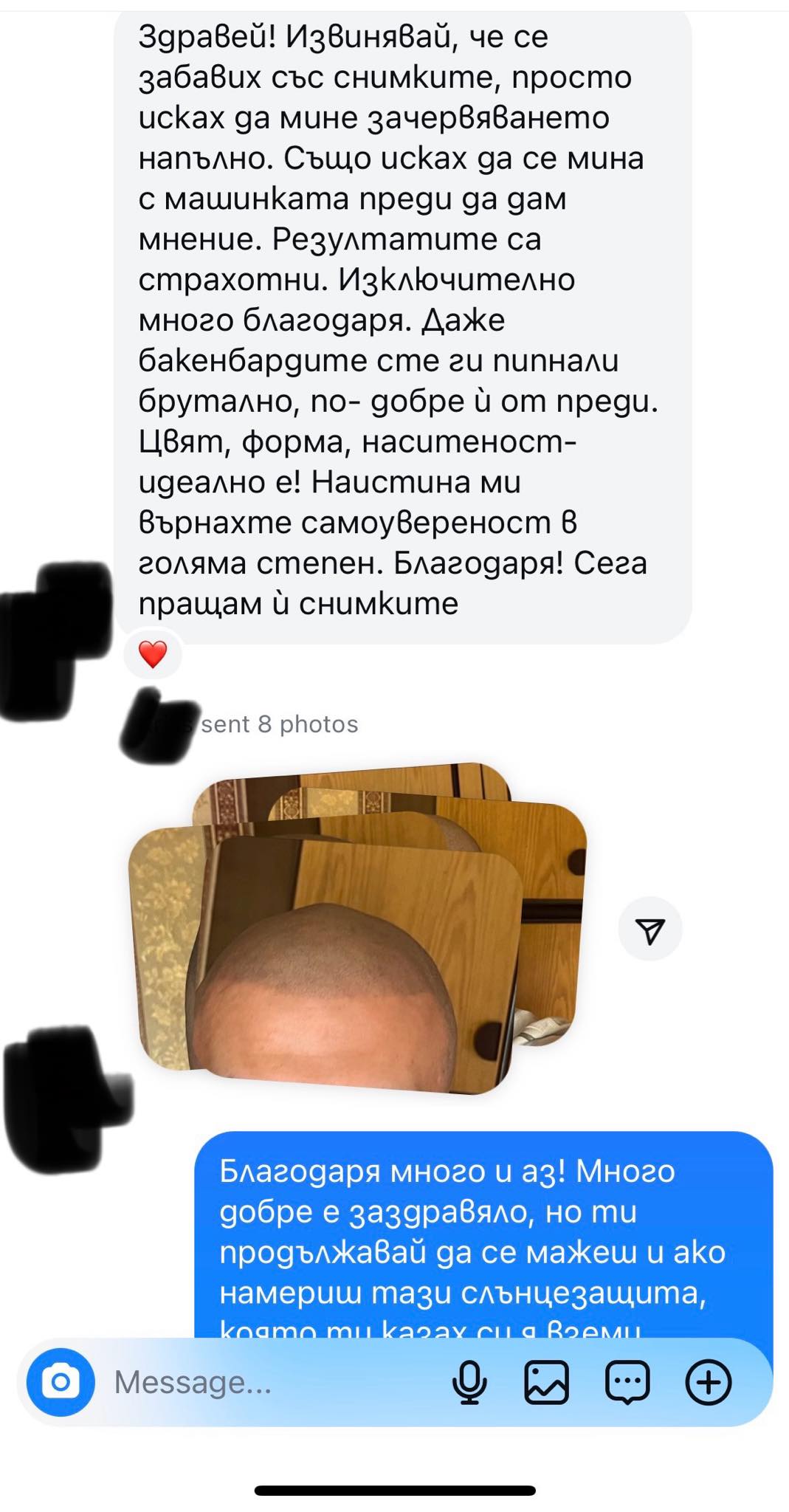 Защо да изберете Панова SMP за своята промяна със скалп микропигментация?